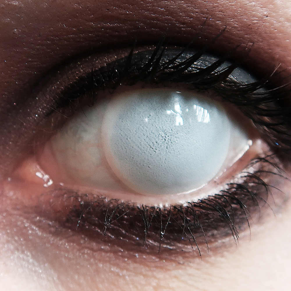 mesmereyez blind white 3